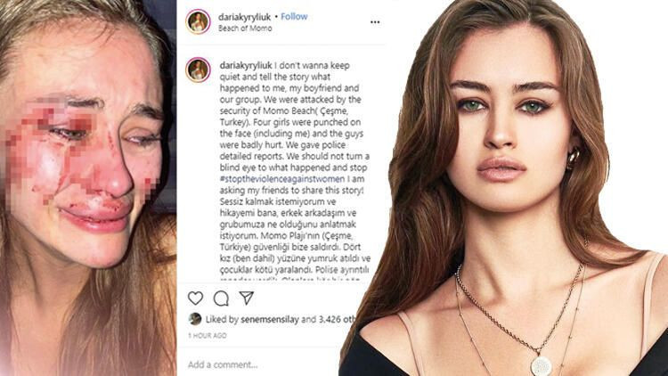 Dünyaca ünlü model Daria Kyryliuk’u sevgilisi mi dövdü? - Resim: 1