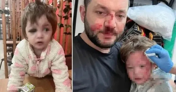 Yalova'da baba ve kızına scooterlı saldırıda iddianame hazır! - Resim : 1