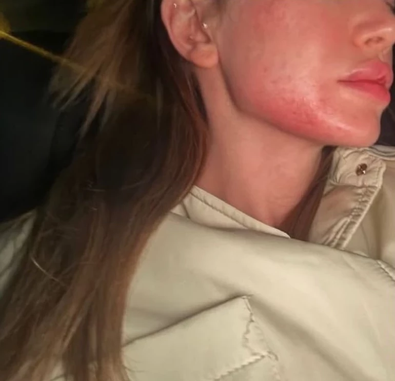 Fenomen Danla Biliç’i darbetmişti! Berk Çetin hakkında flaş karar: Bir hata yaptım - Resim: 3