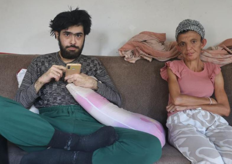 3 yıldır duş almıyordu! Tırnaklarını görenler dehşete düştü - Resim : 2