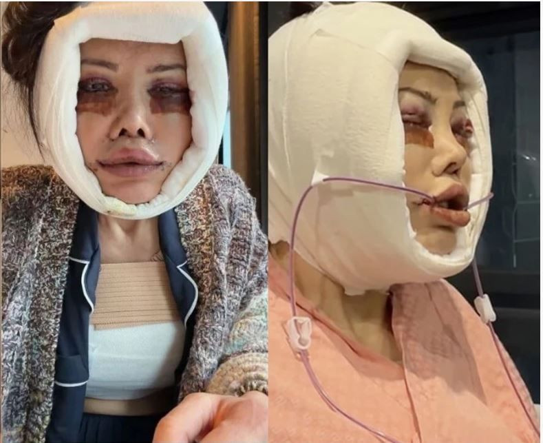Yüz nakli olan Didem Ceran'dan olay paylaşım: Kendisini dünyaca ünlü şarkıcıyla karşılaştırdı - Resim: 2