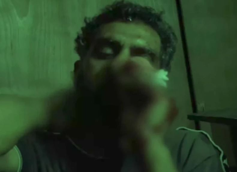 Apar topar hastaneye kaldırılmıştı! Survivor Bayhan'ın sağlık durumuyla ilgili yeni gelişme - Resim: 6