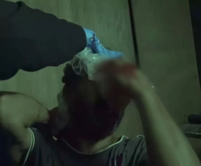 Apar topar hastaneye kaldırılmıştı! Survivor Bayhan'ın sağlık durumuyla ilgili yeni gelişme - Resim: 2