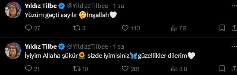 Yüzünde kimyasal yanık oluşmuştu! Yıldız Tilbe hakkında yeni gelişme - Resim: 5