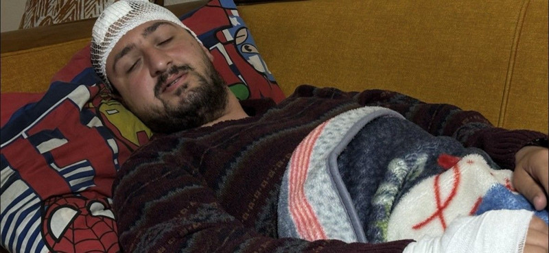 Otizmli genci "odunluğa baktı" diye dövmüştü! O cani hakkında karar - Resim: 1