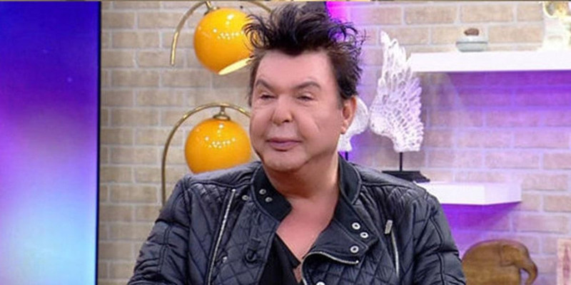 Yüz gerdirme operasyonu geçirmişti! Kuşum Aydın son halini paylaştı - Resim: 2