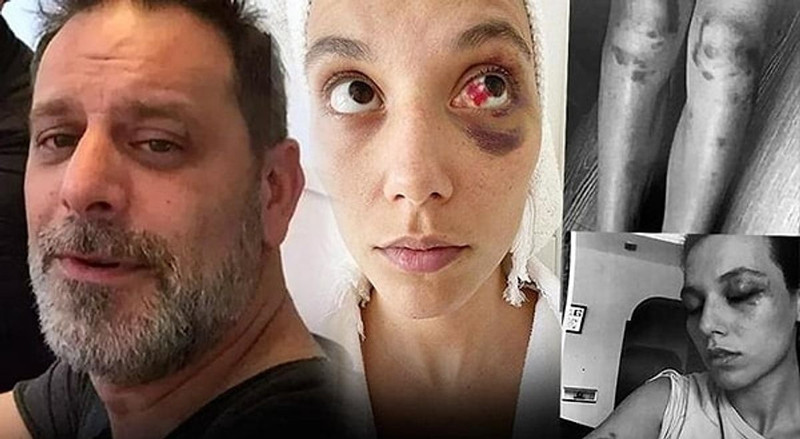Sevgilisini darbettiği gerekçesiyle ceza almıştı! Ozan Güven'in yıllar sonra yaptığı itiraf şoke etti - Resim: 2