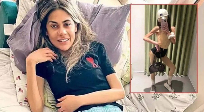 Anoreksiya nedeniyle hayatını kaybetmişti! Öykü Serter'den Nihal Candan itirafı geldi! Gözyaşlarını tutamadı - Resim: 2