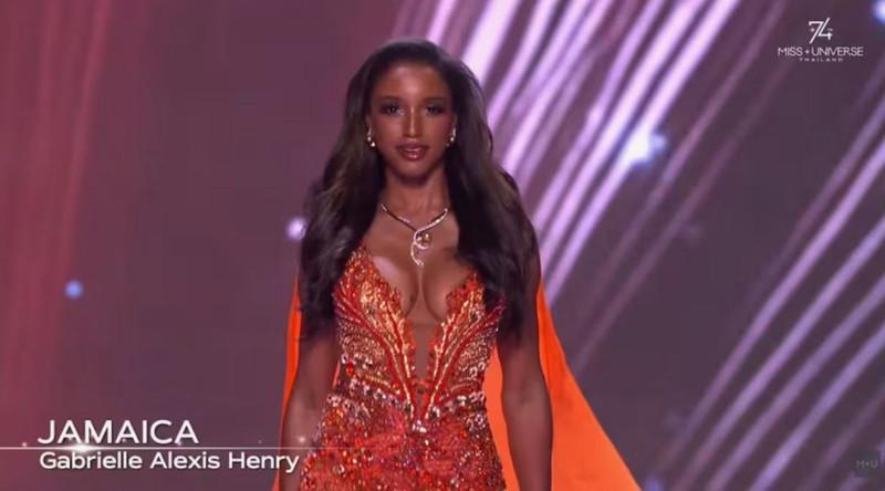 Miss Universe podyumunda kaza geçirmişti! Jamaikalı güzelin tedavisi yoğun bakımda devam ediyor - Resim: 5