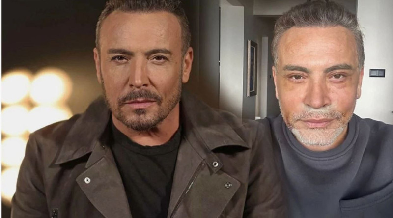 Ünlü Türk sanatçıdan kötü haber! Kaza geçirdi - Resim: 2