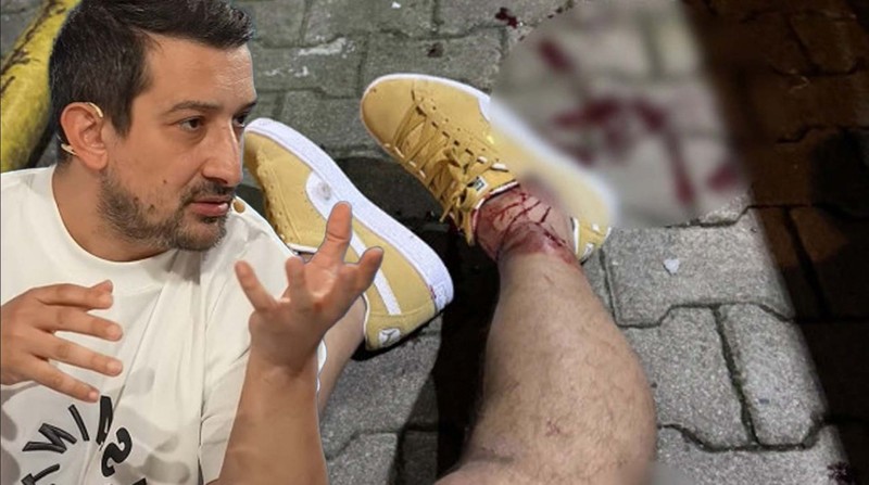 Silahlı saldırıya uğramıştı! Serhat Akın’dan geleceği hakkında radikal karar! - Resim: 6