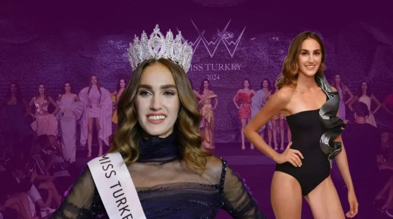 Miss Turkey Birincisi olduktan sonra "Çirkin" diye eleştirilmişti. İdil Bilgen hakkında dikkat çeken gelişme - Resim: 1