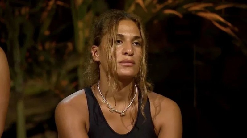 Survivor'dan diskalifiye edilen Almeda Baylan burun estetiği oldu! Operasyon sonrası ilk görüntüsü ortaya çıktı - Resim: 3