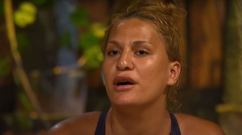 Survivor'dan diskalifiye edilen Almeda Baylan burun estetiği oldu! Operasyon sonrası ilk görüntüsü ortaya çıktı - Resim: 1
