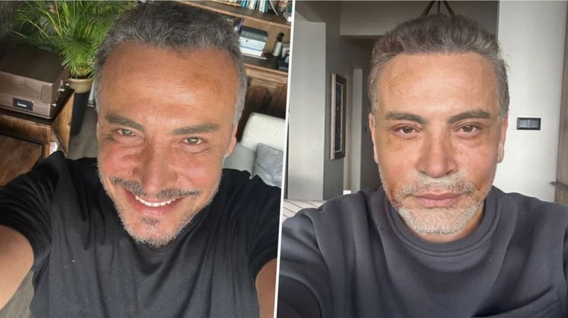 Estetikli ünlüler kervanına katılan Cenk Eren'den nostaljik Ajda Pekkan paylaşımı! "Ben yaşlandım o hâlâ genç" - Resim: 1