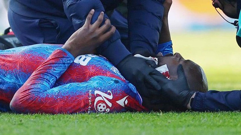 Kalecinin uçan tekmesiyle kanlar içinde kaldı! Yıldız futbolcunun son durumu belli oldu! - Resim: 4