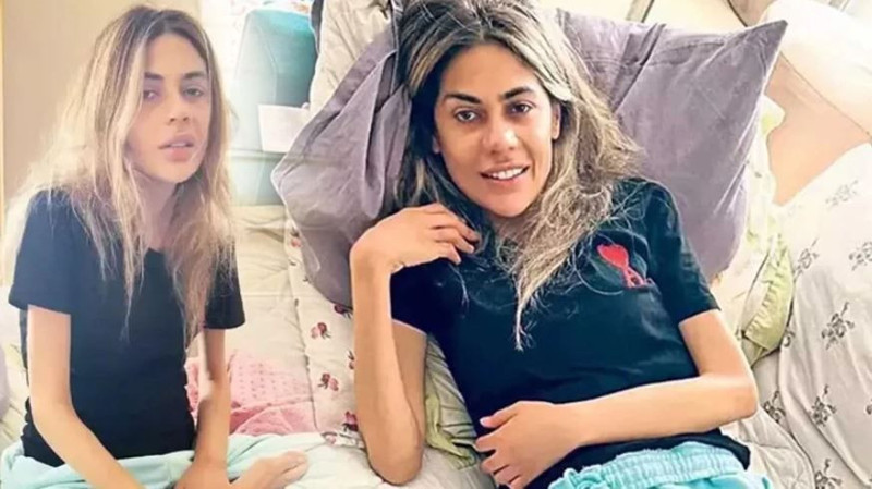 Bahar Candan "Ablam ölüyor" demişti! Nihal Candan’ın yoğun bakımdan görüntüsü ortaya çıktı! 29 kiloya düşmüş - Resim: 2