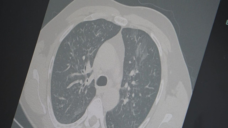 Korkunç salgın yeniden hortladı! 12 Kasım'dan itibaren hepsi kapalı alana alınacak, Türkiye'ye girerse yandık - Resim: 1