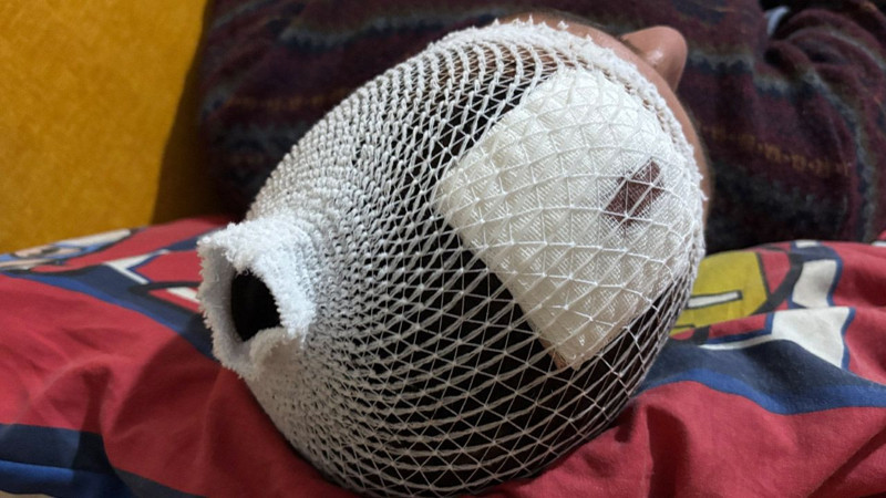 Vicdanları sızlatan olay! “Odunluğa baktı” diye dehşet yaşattılar: Otizmli adamı odunla dövdüler - Resim: 3