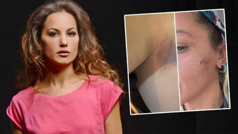 Eşinden şiddet gördüğünü duyurmuştu! Yıldız Asyalı'dan korkutan paylaşım geldi! "Umarım başıma kötü bir şey gelmez" - Resim: 3