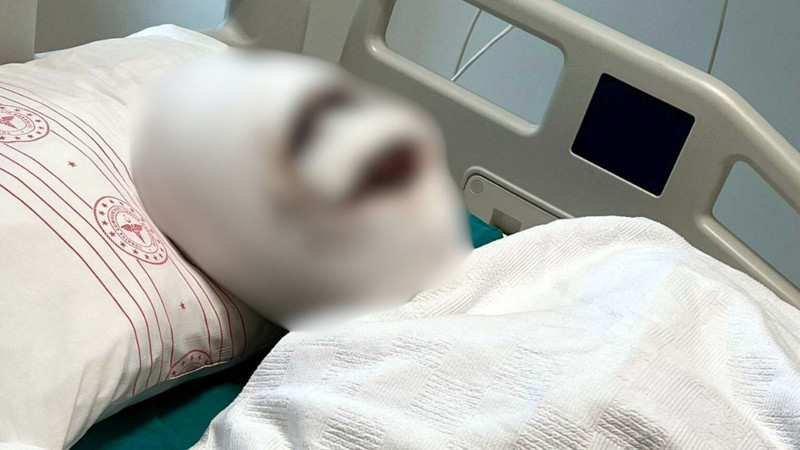 Gaziantep'i sarsan eski koca vahşeti: Kadını bağladı, kezzap döktü! - Resim: 6