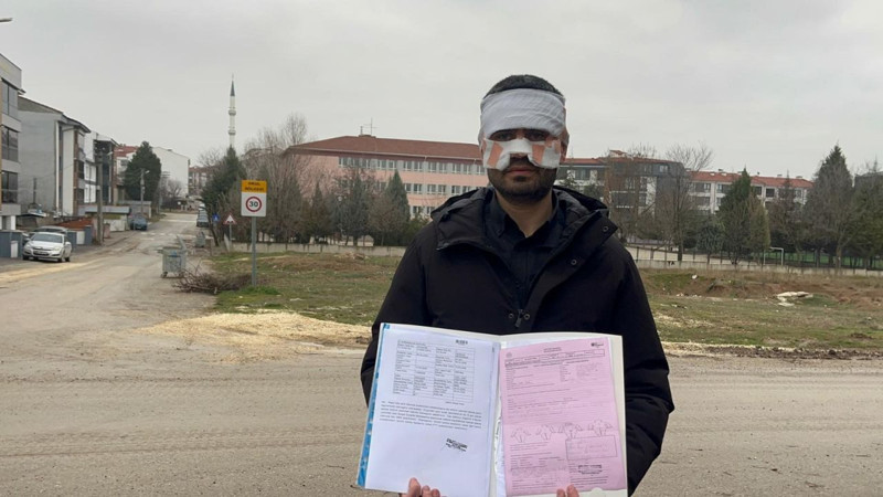 Okulda şok iddia! Öğretmen, meslektaşının yüzüne sıcak çay fırlattı - Resim: 3