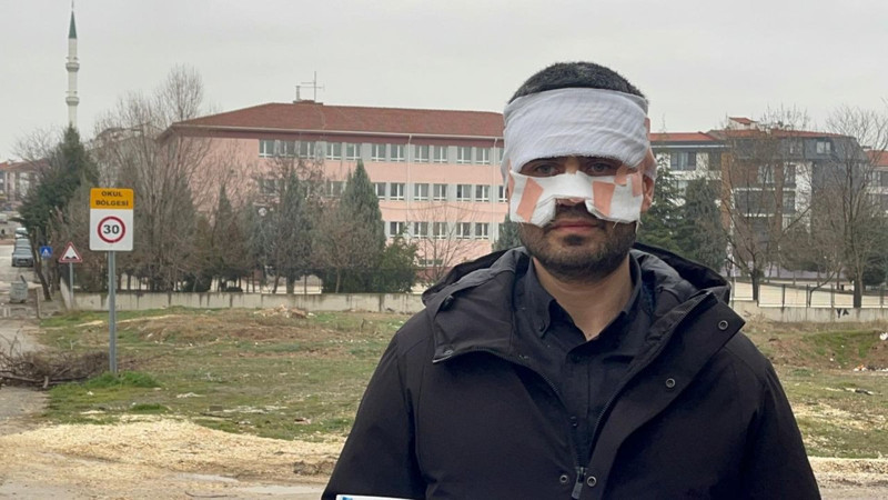 Okulda şok iddia! Öğretmen, meslektaşının yüzüne sıcak çay fırlattı - Resim: 2