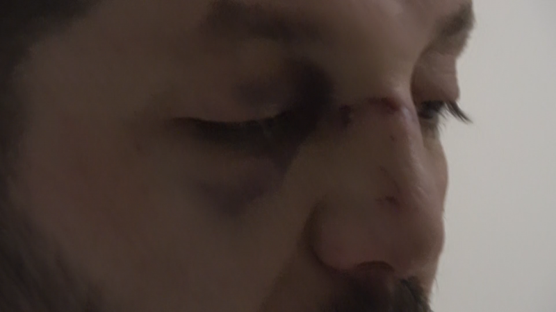 Yalova'da kan donduran olay! Çocuğuyla dehşeti yaşadı: 14 aylık bebeğin kafatası çatladı! - Resim: 5