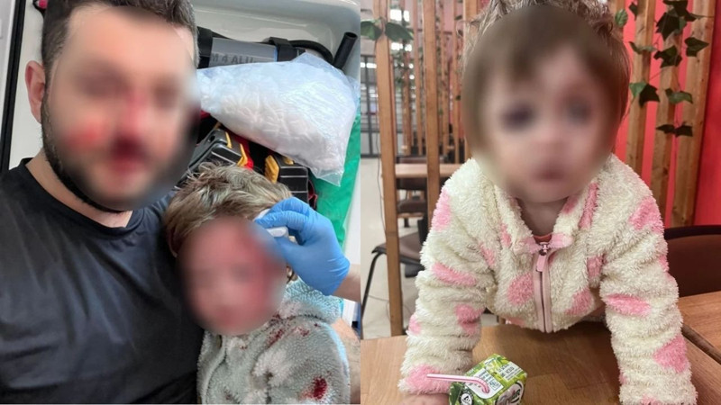 14 aylık bebeği darbetmişlerdi! Şüphelilerden pişkin savunma: Kucağındaki çocuğu fark etmemişim bile - Resim: 9