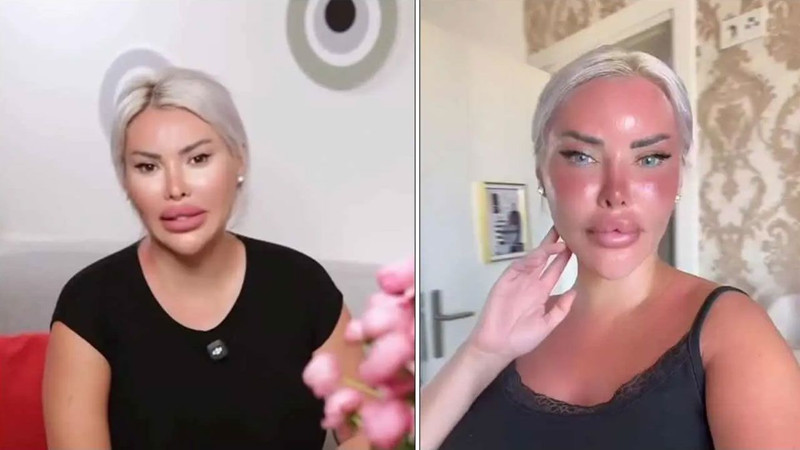 Estetik bağımlılığı bunu da yaptırdı! Ünlü fenomen Pınar Özkurteller gözlerini maviye boyattı, son hali olay oldu - Resim: 3