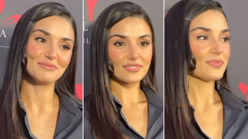 Hande Erçel'e estetik sorusu! Verdiği yanıt şaşırttı - Resim: 5