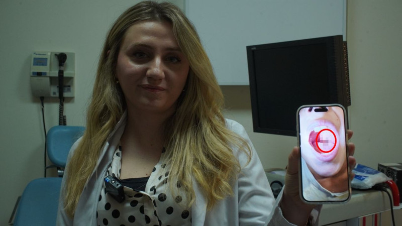 Bademcik diye gitti, doktor görünce şoke oldu! Çocuğun boğazından sülük çıktı - Resim: 5