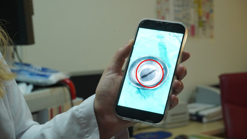 Bademcik diye gitti, doktor görünce şoke oldu! Çocuğun boğazından sülük çıktı - Resim: 4