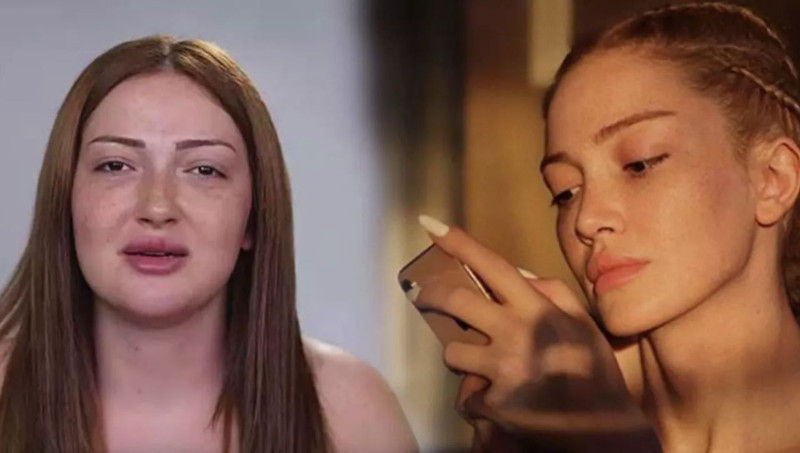 Bambaşka birine dönüşmüştü! Danla Bilic'in estetiklerine harcadığı para dudak uçuklattı! - Resim: 2