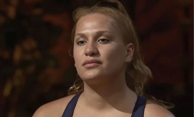 Survivor'dan diskalifiye edilen Almeda Baylan burun estetiği oldu! Operasyon sonrası ilk görüntüsü ortaya çıktı - Resim: 2