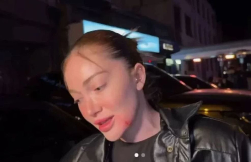 Danla Bilic'i darp edip ölüm tehditlerinde bulunmuştu! Eski sevgili Berk Çetin hakkında karar çıktı - Resim: 6