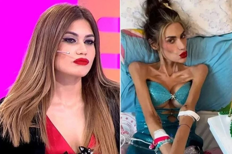 Anoreksiya nedeniyle hayatını kaybetmişti! Nihal Candan'ın acılı babası ilk kez konuştu! "Şöhret dünyasına girince sapıttı" - Resim: 4