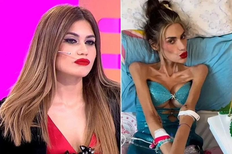 Anoreksiya nedeniyle hayatını kaybetmişti! Öykü Serter'den Nihal Candan itirafı geldi! Gözyaşlarını tutamadı - Resim: 4