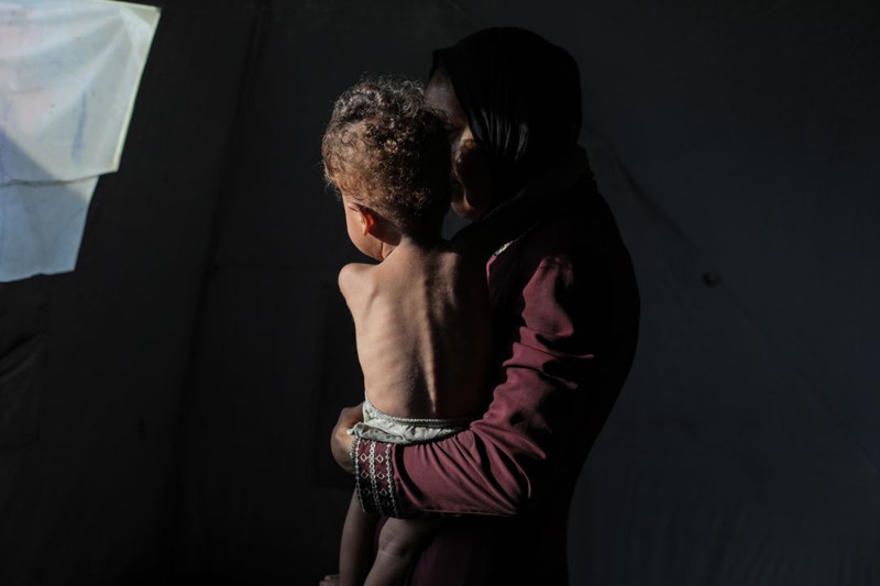 Gazze'de insani kriz derinleşiyor! 217 kişi açlıktan öldü! 100 tanesi çocuk... - Resim: 4