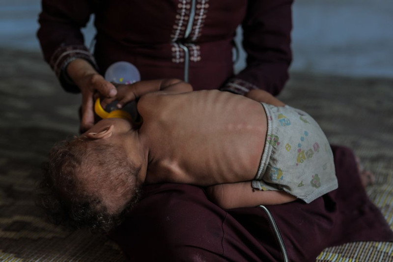 Gazze'de insani kriz derinleşiyor! 217 kişi açlıktan öldü! 100 tanesi çocuk... - Resim: 7