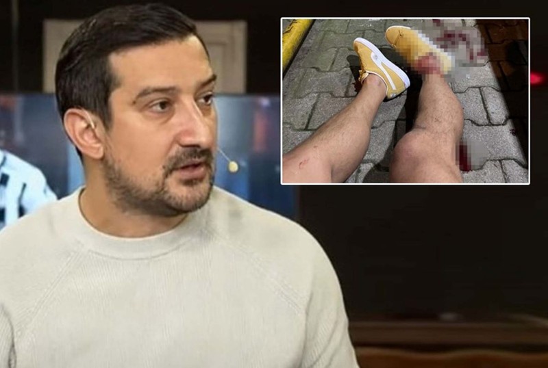 Silahlı saldırıya uğramıştı! Serhat Akın’dan geleceği hakkında radikal karar! - Resim: 4
