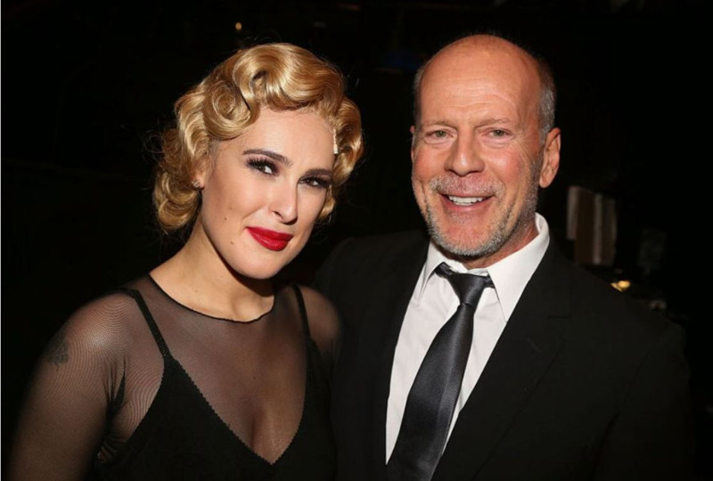 Demans ve afazi hastalığıyla mücadele ediyordu! Dünyaca ünlü oyuncudan üzen haber - Resim: 5