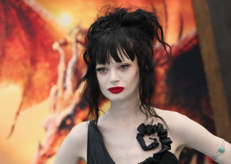 Ünlü oyuncudan kötü haber! İkinci bacağını da kaybetti - Resim: 1