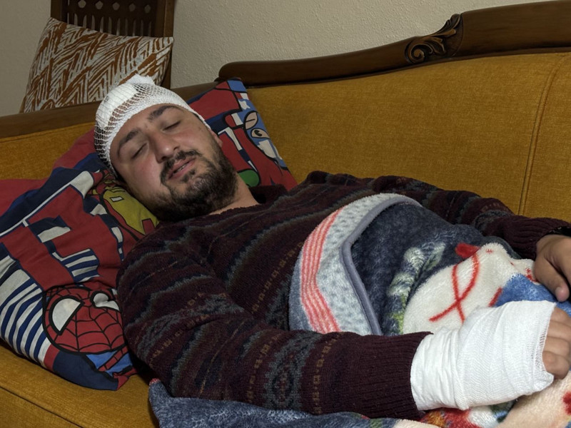 Vicdanları sızlatan olay! “Odunluğa baktı” diye dehşet yaşattılar: Otizmli adamı odunla dövdüler - Resim: 1