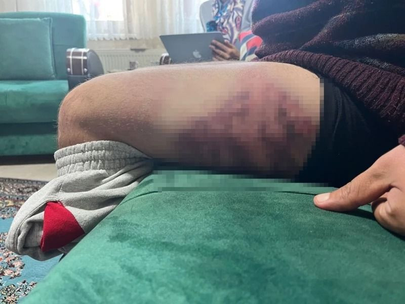 Otizmli genci "odunluğa baktı" diye dövmüştü! O cani hakkında karar - Resim: 3