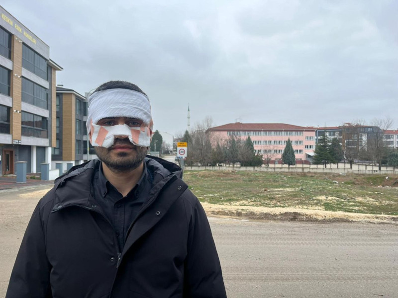 Okulda şok iddia! Öğretmen, meslektaşının yüzüne sıcak çay fırlattı - Resim: 5