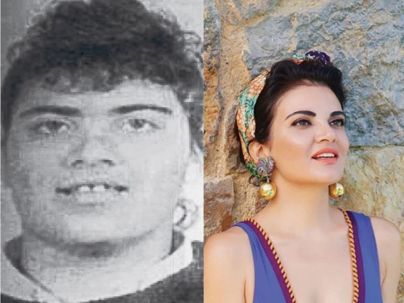 Yıllar içerisindeki değişimiyle gündemdeydi! Şarkıcı Göksel estetik iddialarına son noktayı koydu - Resim: 2