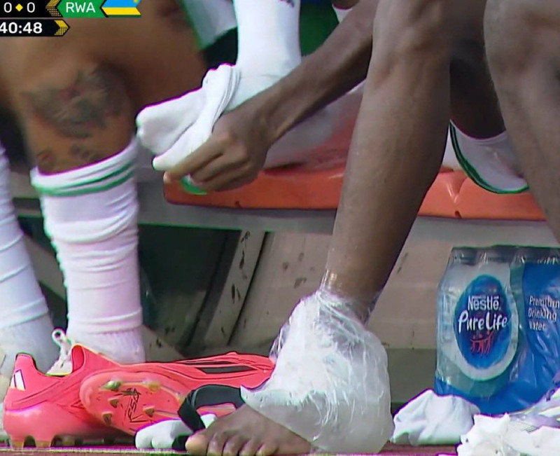 Milli takımda sakatlanmıştı! Okan Buruk kararını verdi! Osimhen’in yerine oynayacak isim belli oldu - Resim: 2