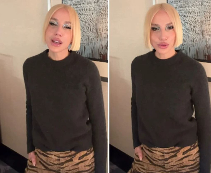 Ünlü şarkıcı Gülşen'in son halini görenler şaştı kaldı! "Botoksu fazla kaçırmış" - Resim: 5