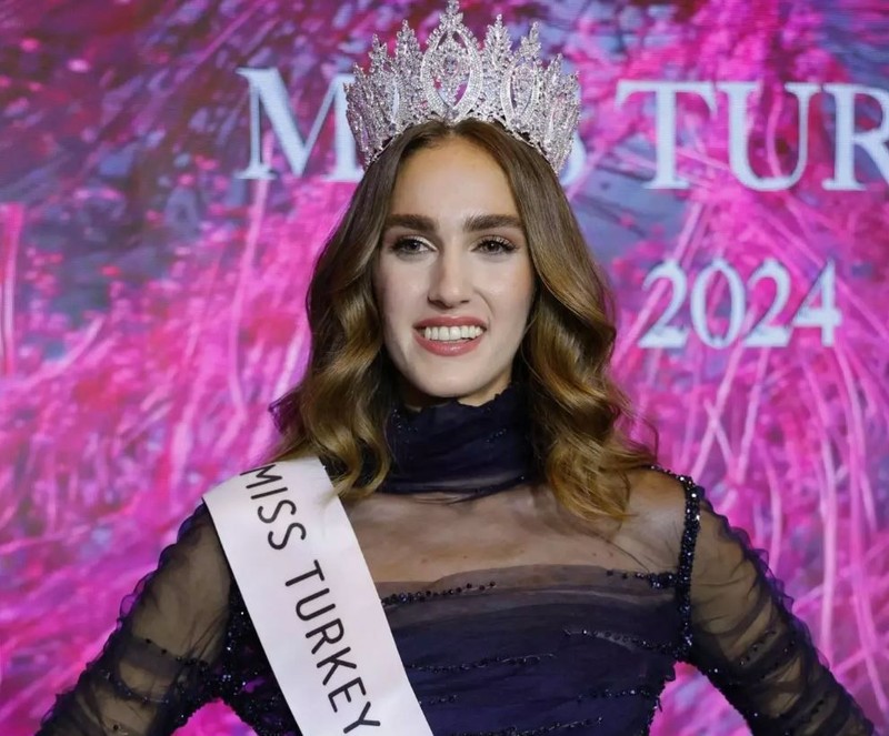 Miss Turkey Birincisi olduktan sonra "Çirkin" diye eleştirilmişti. İdil Bilgen hakkında dikkat çeken gelişme - Resim: 2